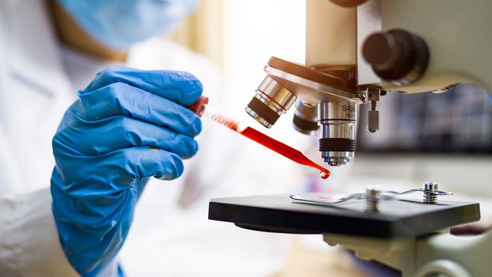 Testing A Blood Sample — Forsyth, NC — Safe Ride Transportation Testing A Blood Sample — Forsyth, NC — Safe Ride Transportation