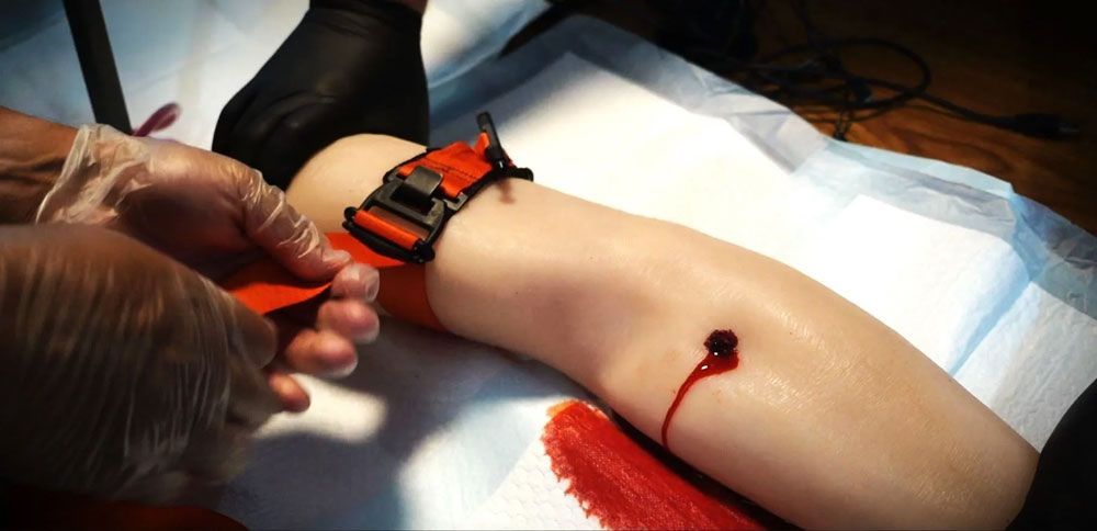 A leg with a tourniquet and wound being treated. Hands in gloves are visible.
