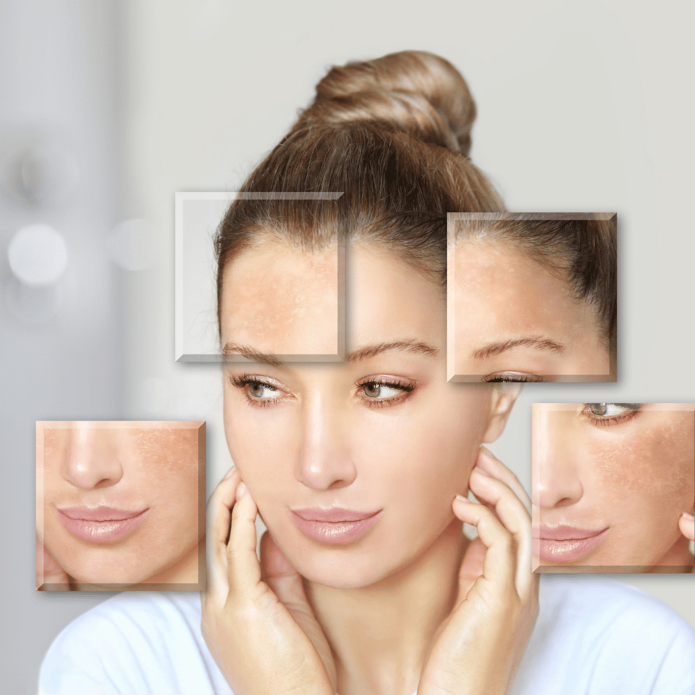 Medical dermatology consultation for rosacea and eczema in Gangnam