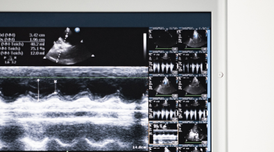 A tablet screen shows an ultrasound of a heart