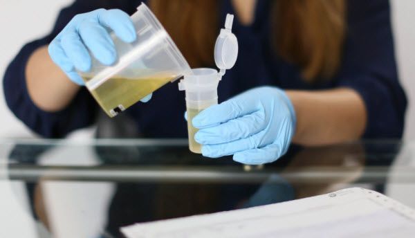 A woman wearing blue gloves is pouring urine into a container.