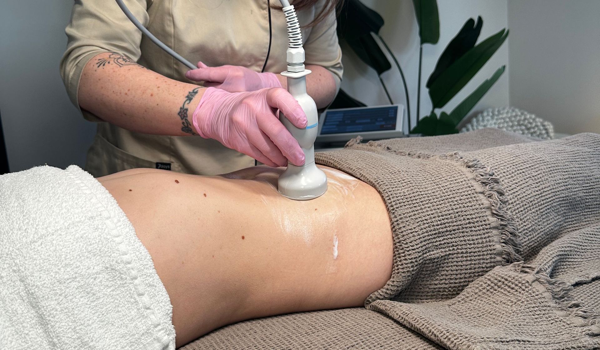 Bei einer Frau wird eine Ultraschalluntersuchung des Bauches durchgeführt.