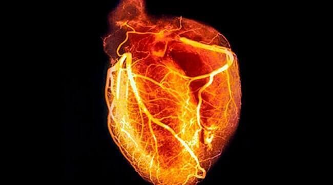 DR. JUAN MANUEL CORTES CEJA - Valoración cardiológica pre-operatoria