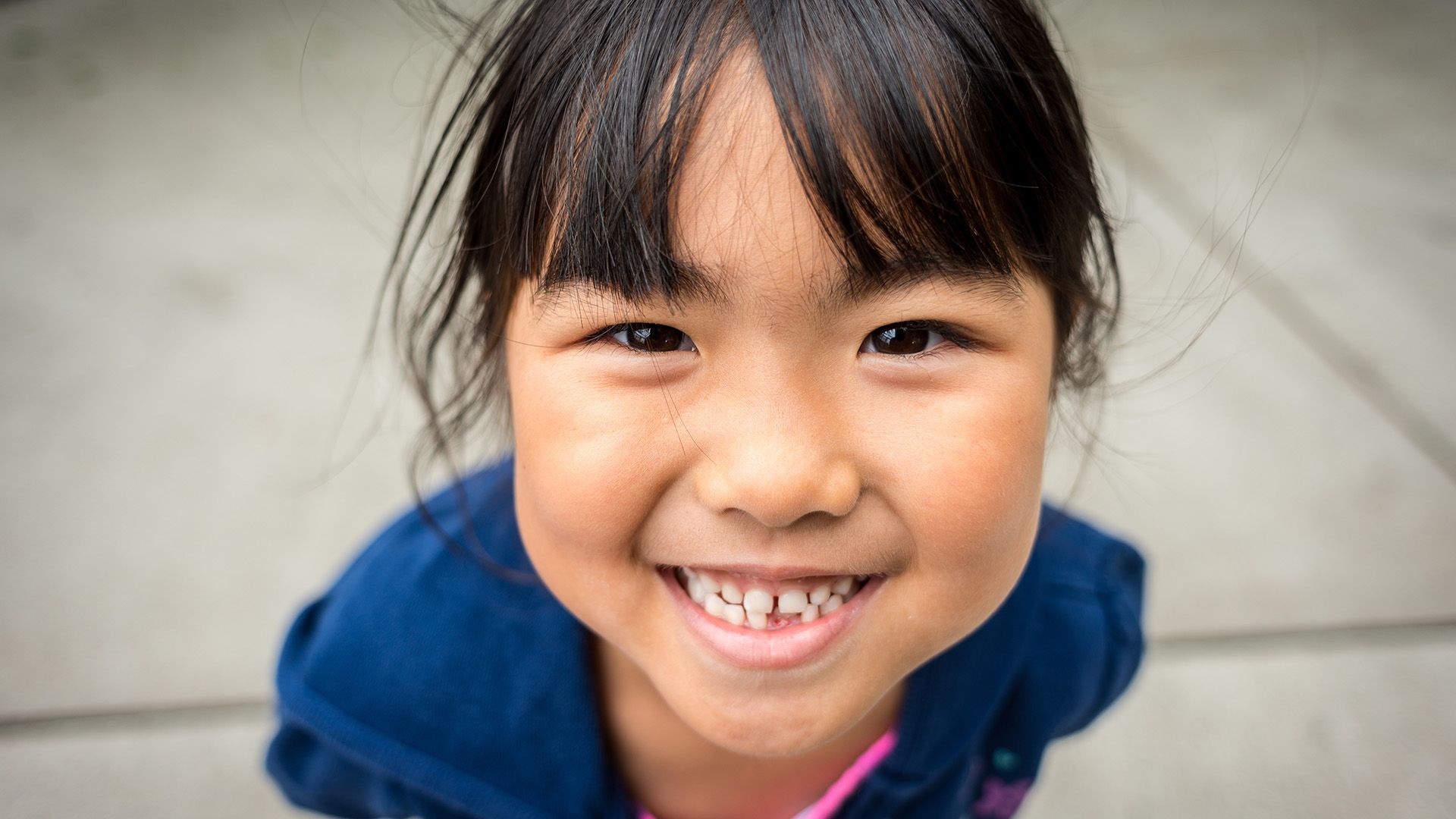 What Causes Gingivitis in Kids?