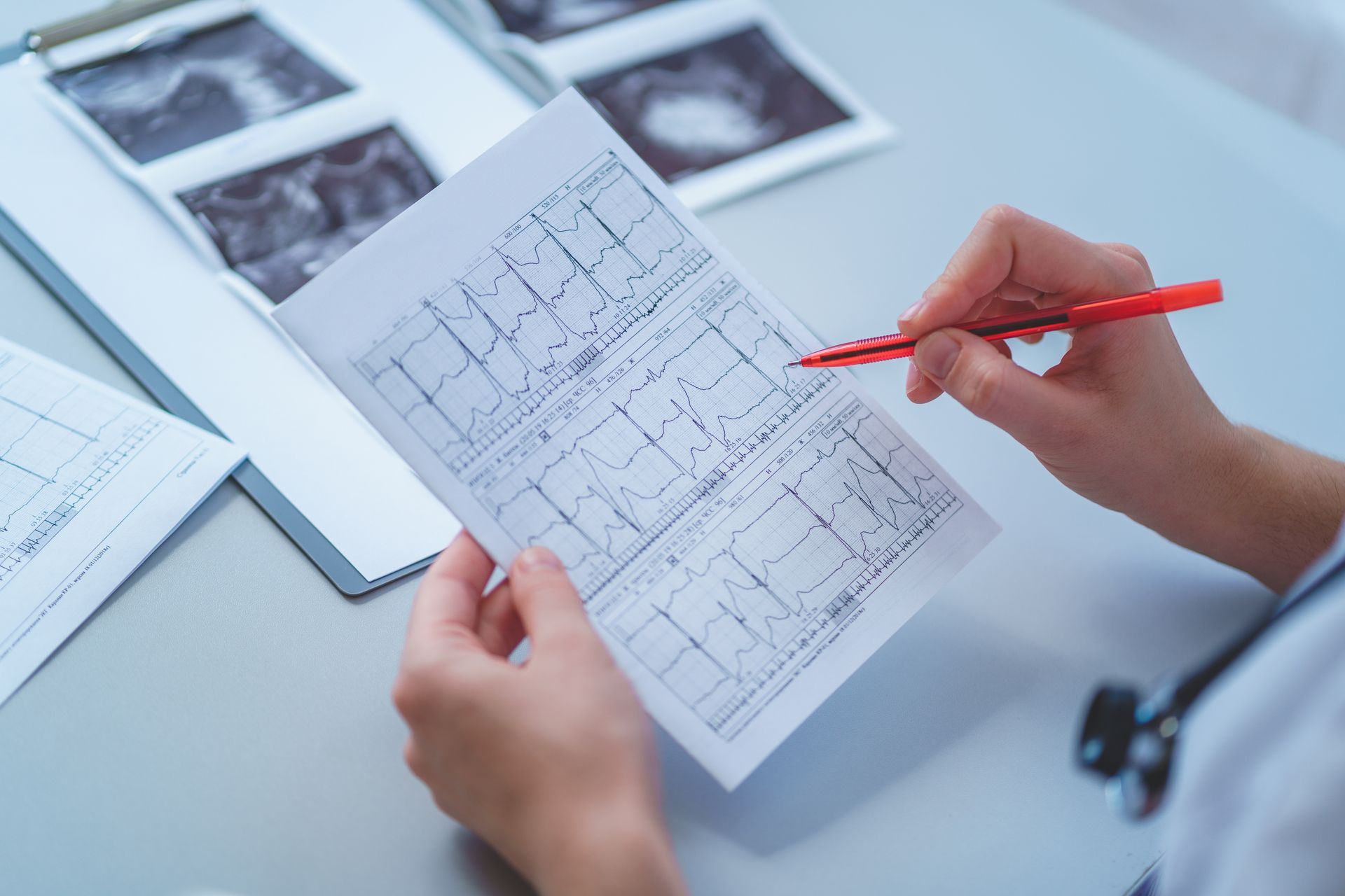 Hands reviewing medical scans and notes with a red pen on a desk Hands reviewing medical scans and notes with a red pen on a desk