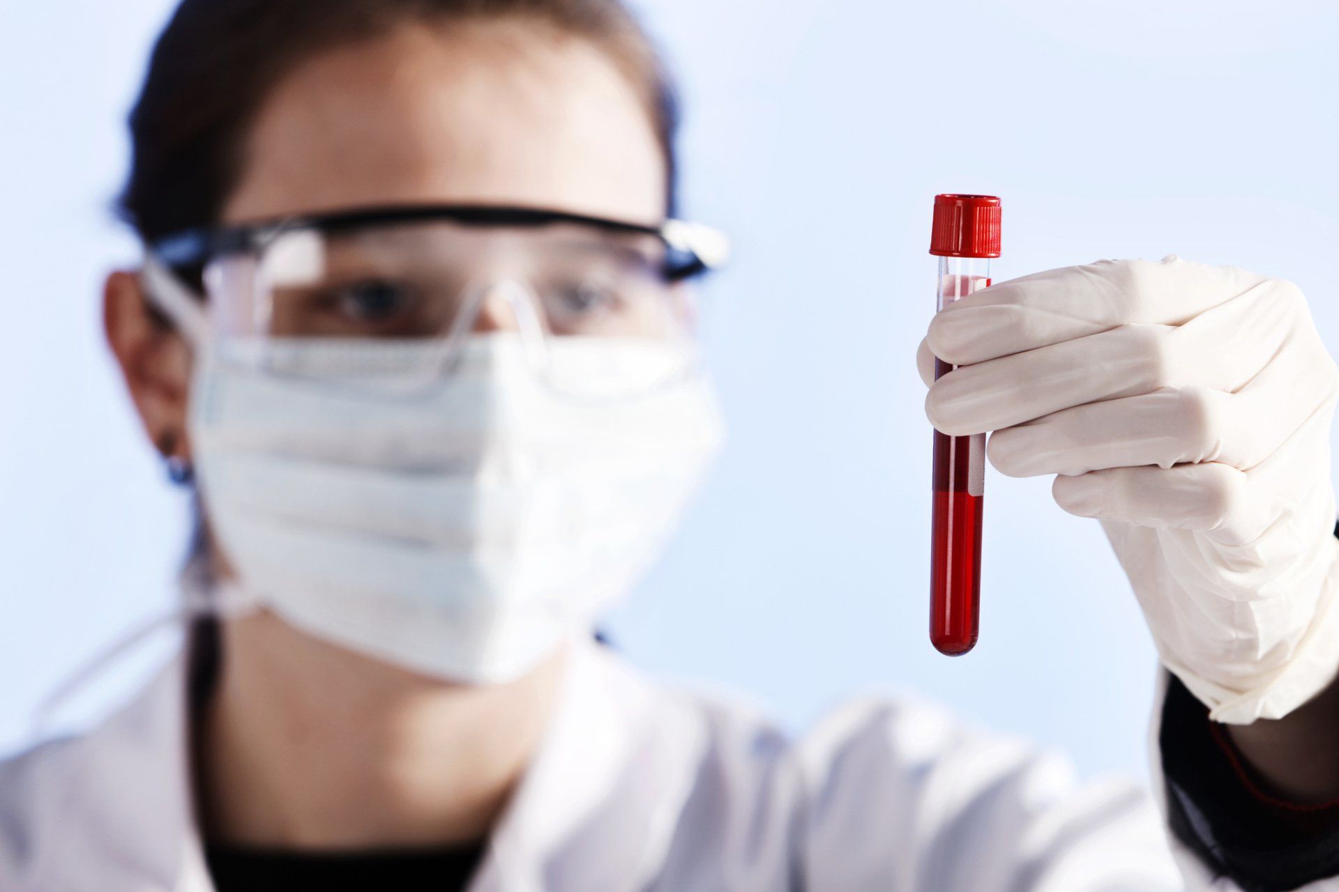 ESAMI DEL SANGUE E DELLE URINE LECCE