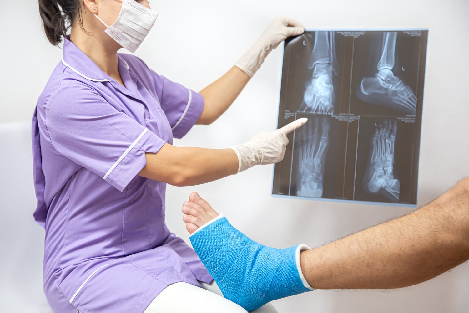 Clinician in purple scrubs points to X-ray films while examining a patient's bandaged foot
