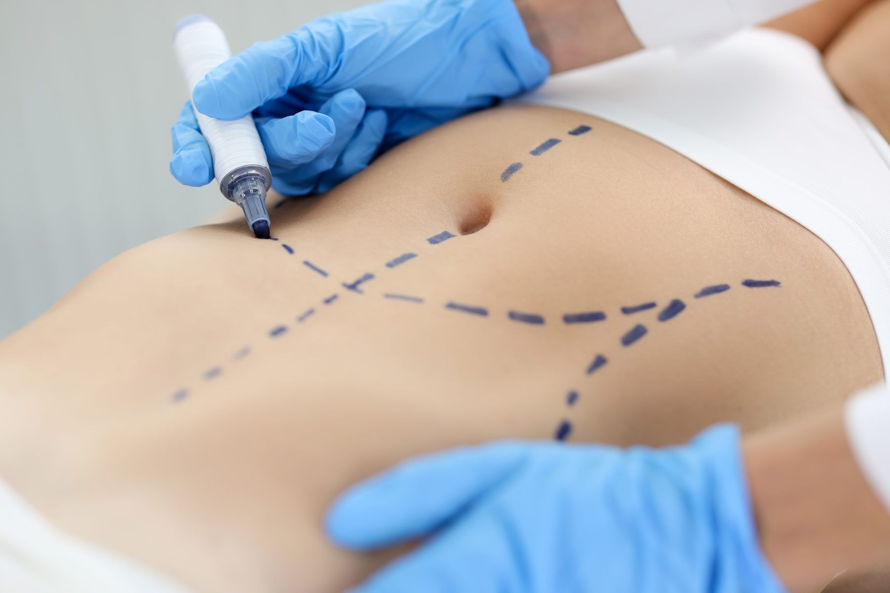 CIRUGIA PLASTICA Y RECONSTRUCTIVA