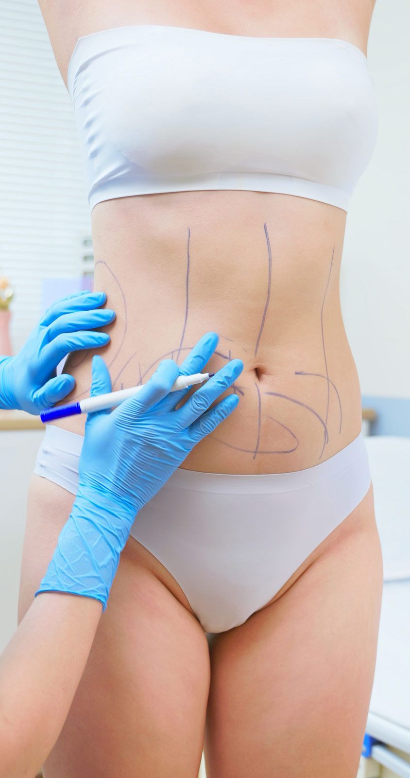 CIRUGIA PLASTICA Y RECONSTRUCTIVA