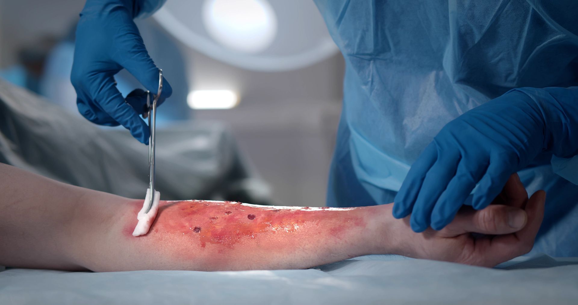 Arm being cleaned during a medical procedure with blood and open wound. Surgeon's gloved hands and tools are in view.