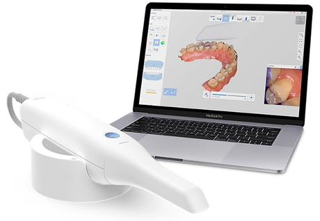 Uno scanner intraorale dentale bianco è appoggiato sulla sua base accanto a un computer portatile che visualizza un modello digitale 3D di un'arcata dentale.