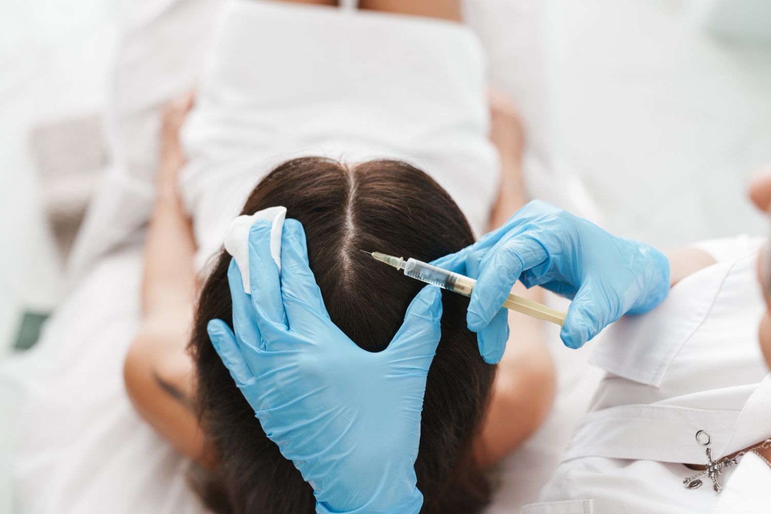 alopecie femme dr philippe yaeche Rouen