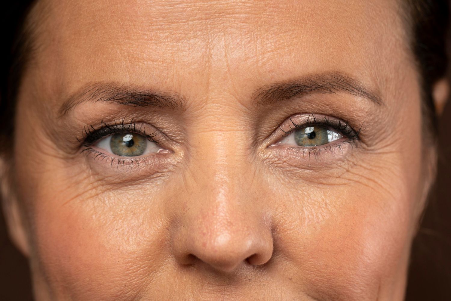 blepharoplastie medicale