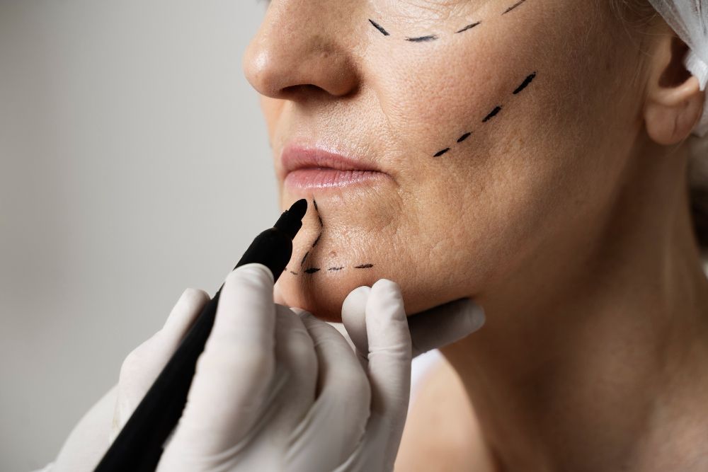 cabinet Dr Philippe Yaeche medecine esthetique rouen