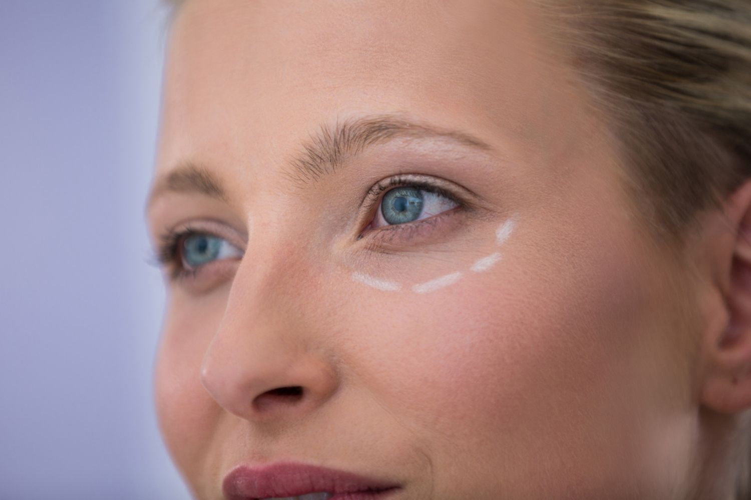 blepharoplastie medicale