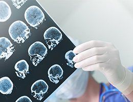 Electroencephalogram — Galena, OH — Big Walnut Family Physical Therapy Electroencephalogram — Galena, OH — Big Walnut Family Physical Therapy
