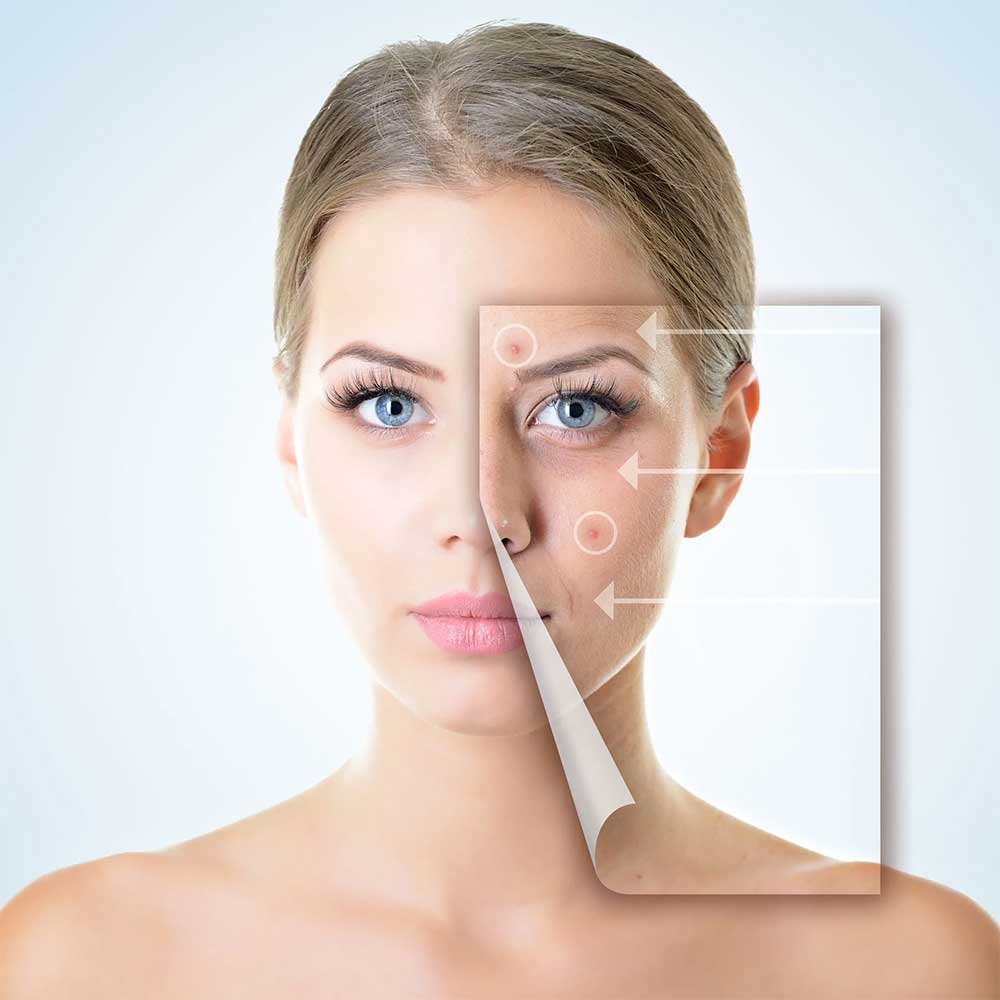 a woman 's face is shown with arrows pointing to different areas of her face