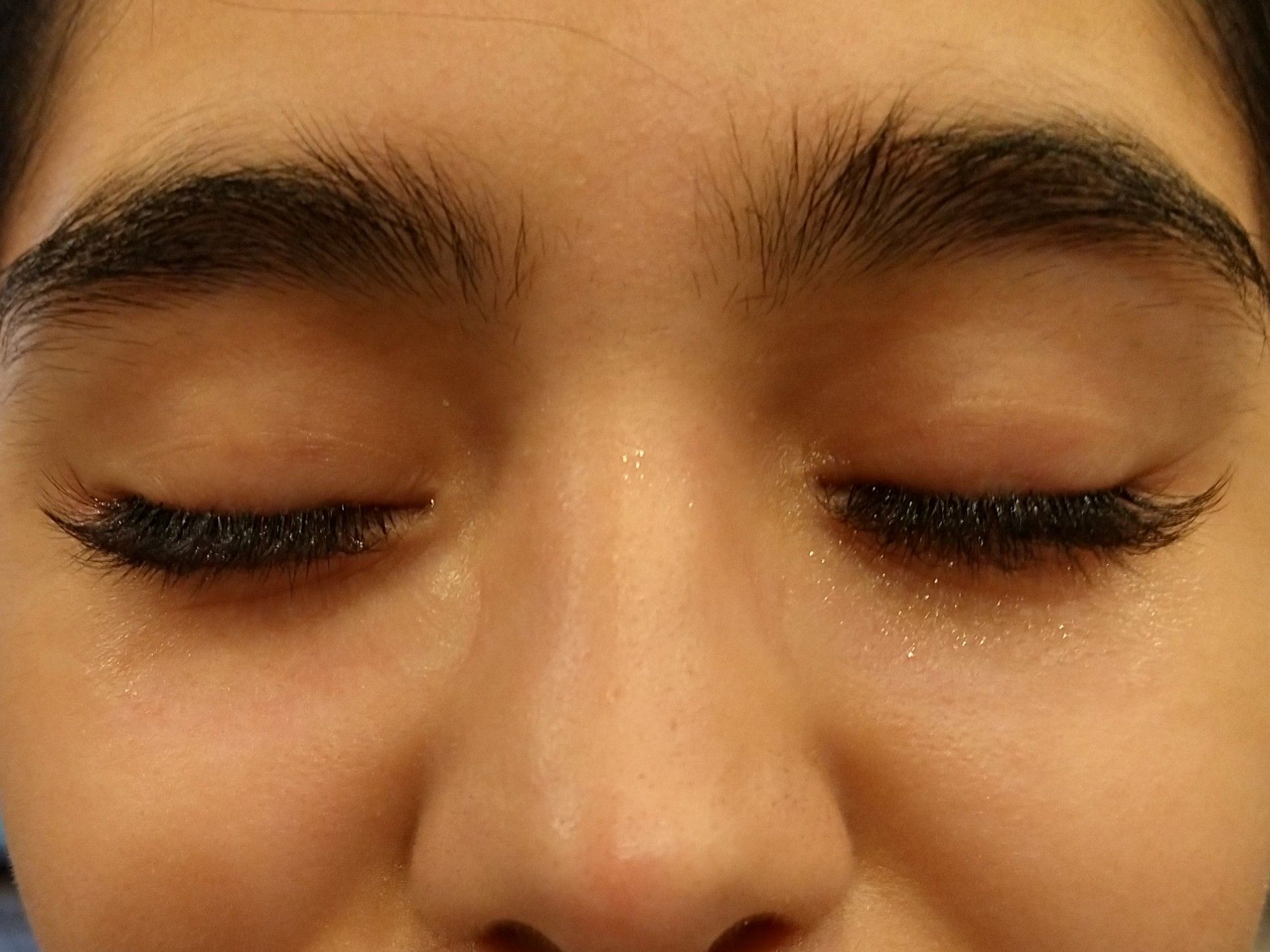 Eyelashes | Lake Geneva, WI | Bare Essentials Laser and Electrolysis
