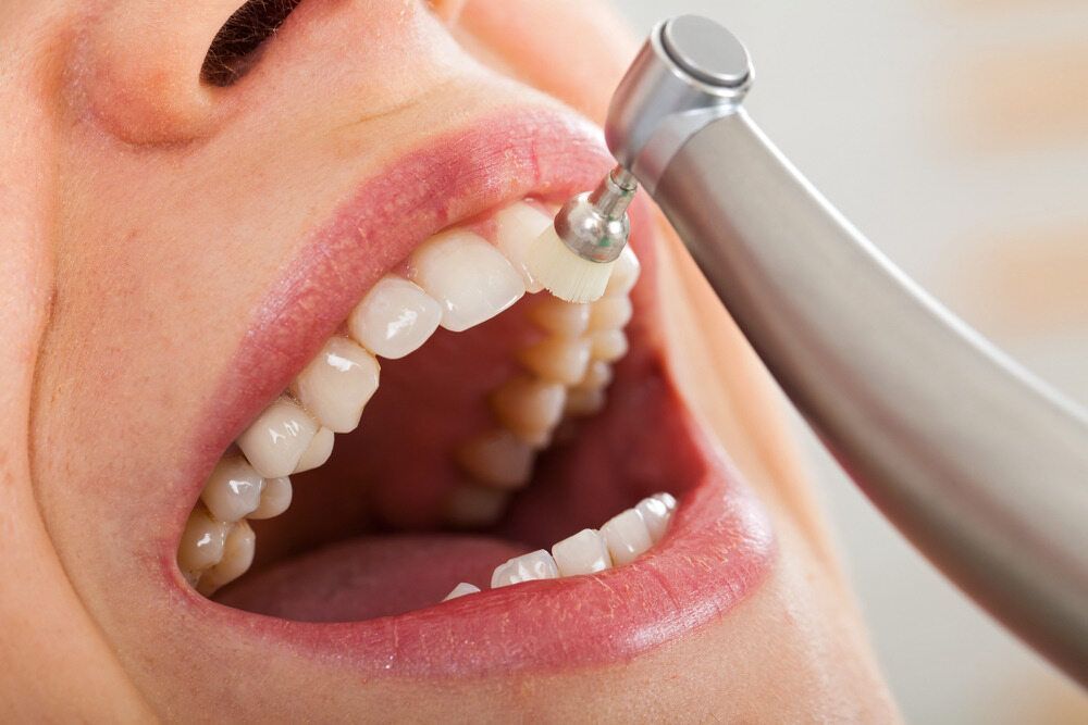 A Woman is Getting Her Teeth Cleaned by a Dentist — Parap Family Dental in Parap, NT