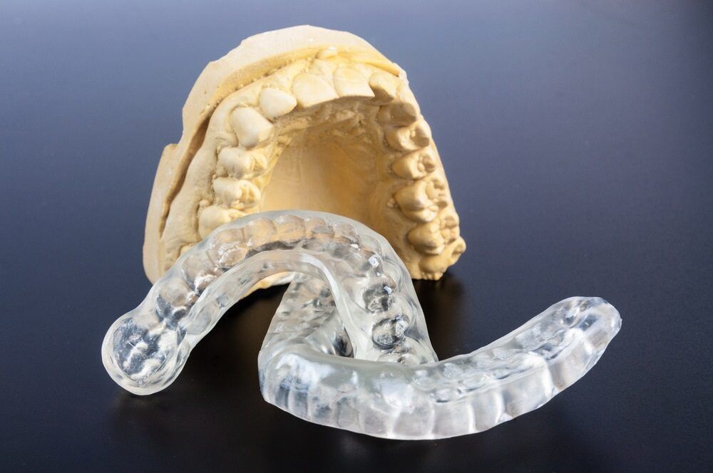A Dental Model and a Clear Mouth Guard on a Table — Parap Family Dental in Parap, NT