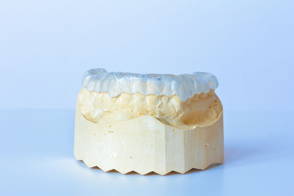 A Model of a Person's Teeth on a White Surface — Parap Family Dental in Parap, NT