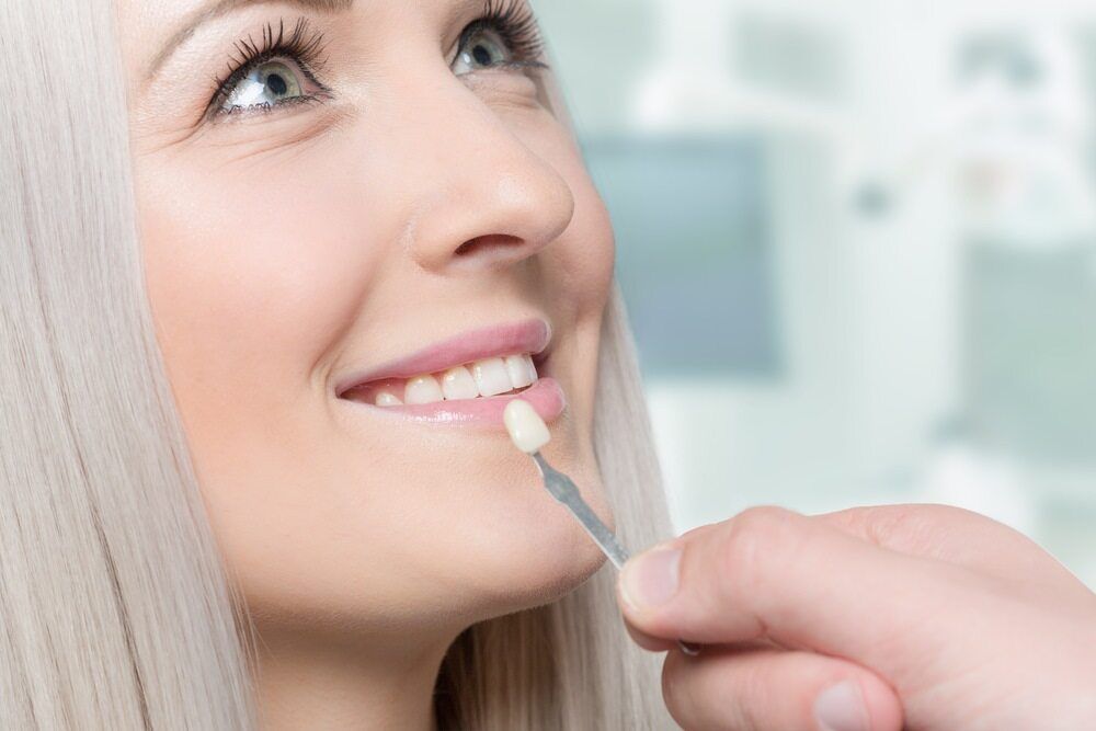 Shade Guide Held to Woman's Teeth for Veneer Color Match — Parap Family Dental in Parap, NT