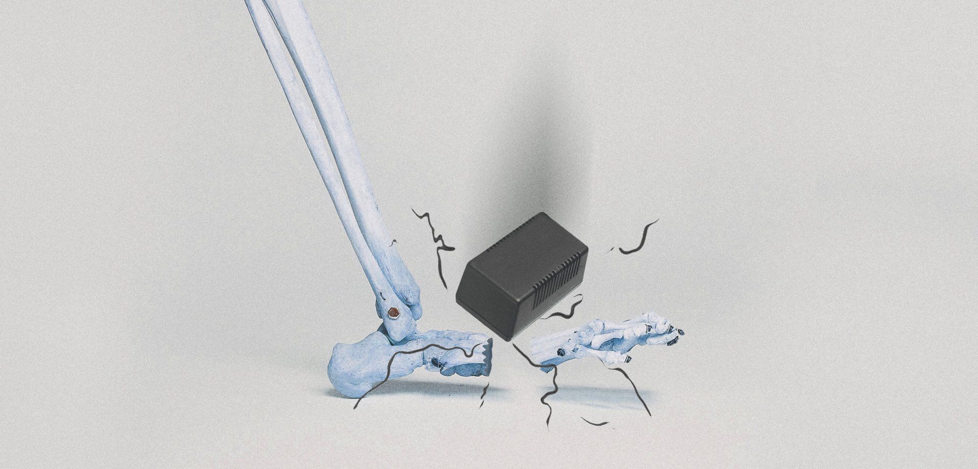 A power supply is breaking bones.