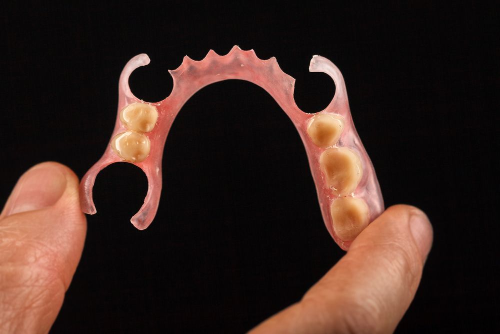 A person is holding a denture in their hand. — Burleigh Heads Denture Clinic Gold Coast in Burleigh Heads, QLD