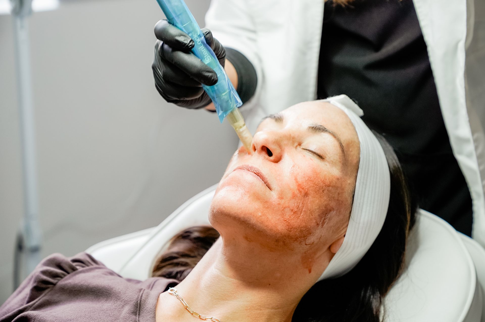 prf injection service