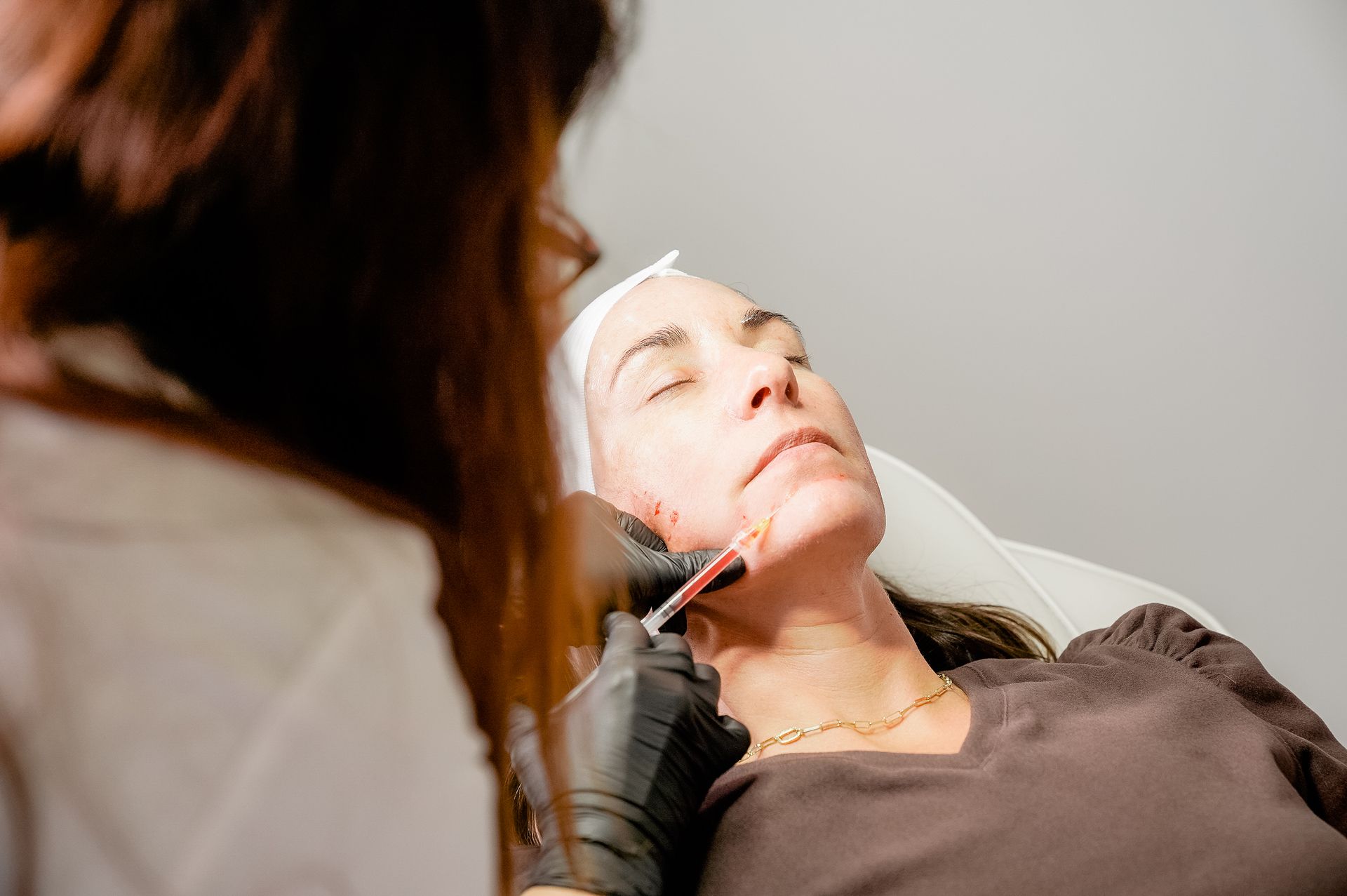 prf injection service
