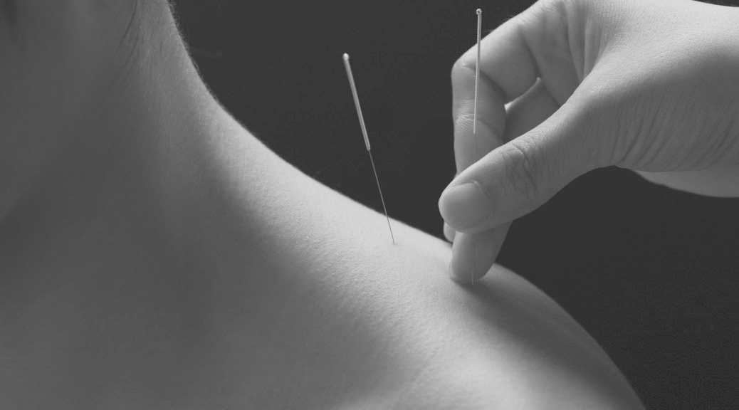 Acupunctuur Wassenaar