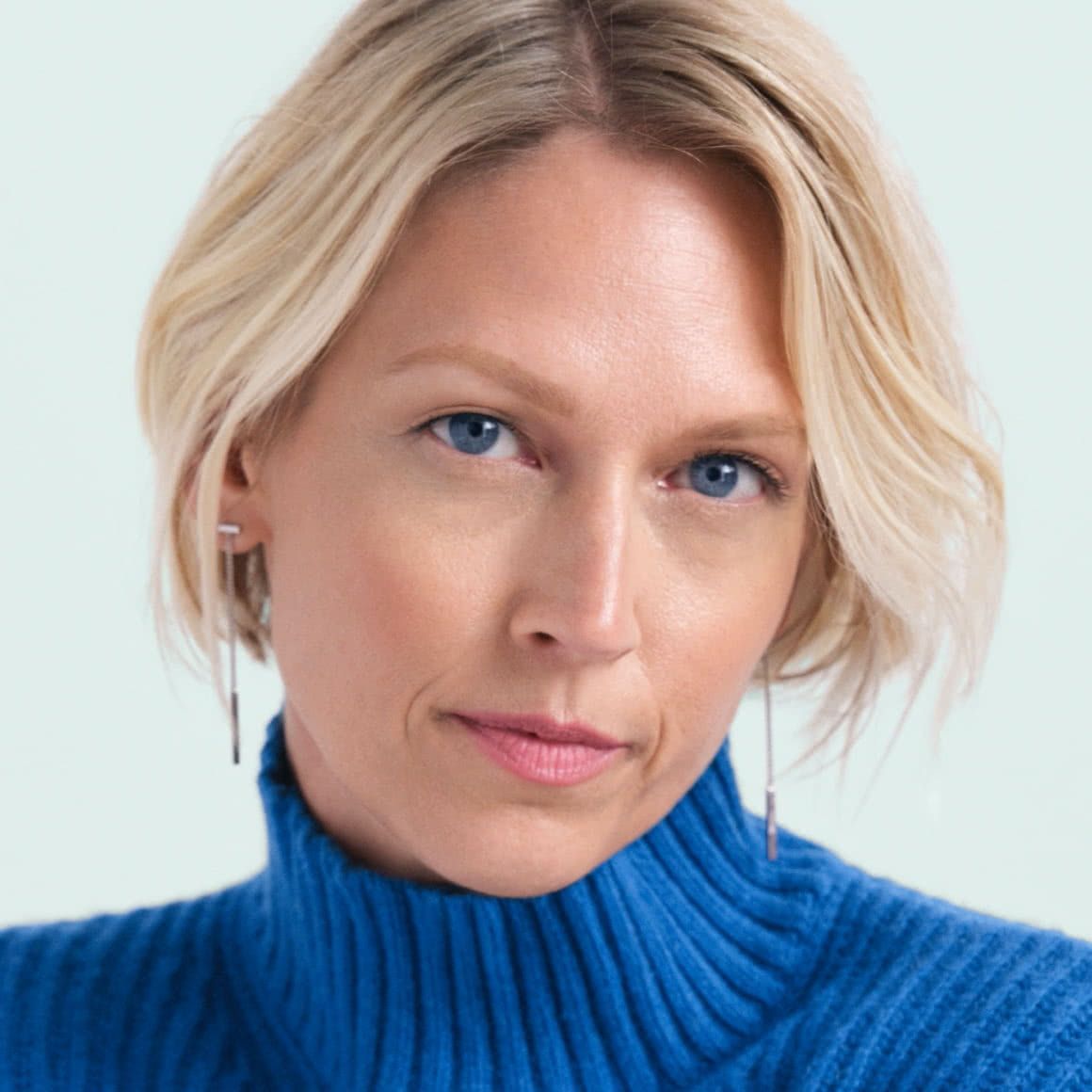 Radiesse Filler