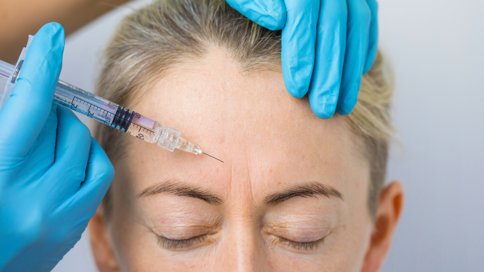 Botox in Baltimore, MD. At Vanity Skin Bar