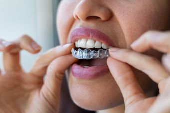 a woman is putting a clear brace on her teeth .