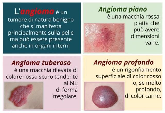 Medico che esamina il braccio di un paziente con un dermatoscopio. Paziente sorride, ambiente ambulatoriale.