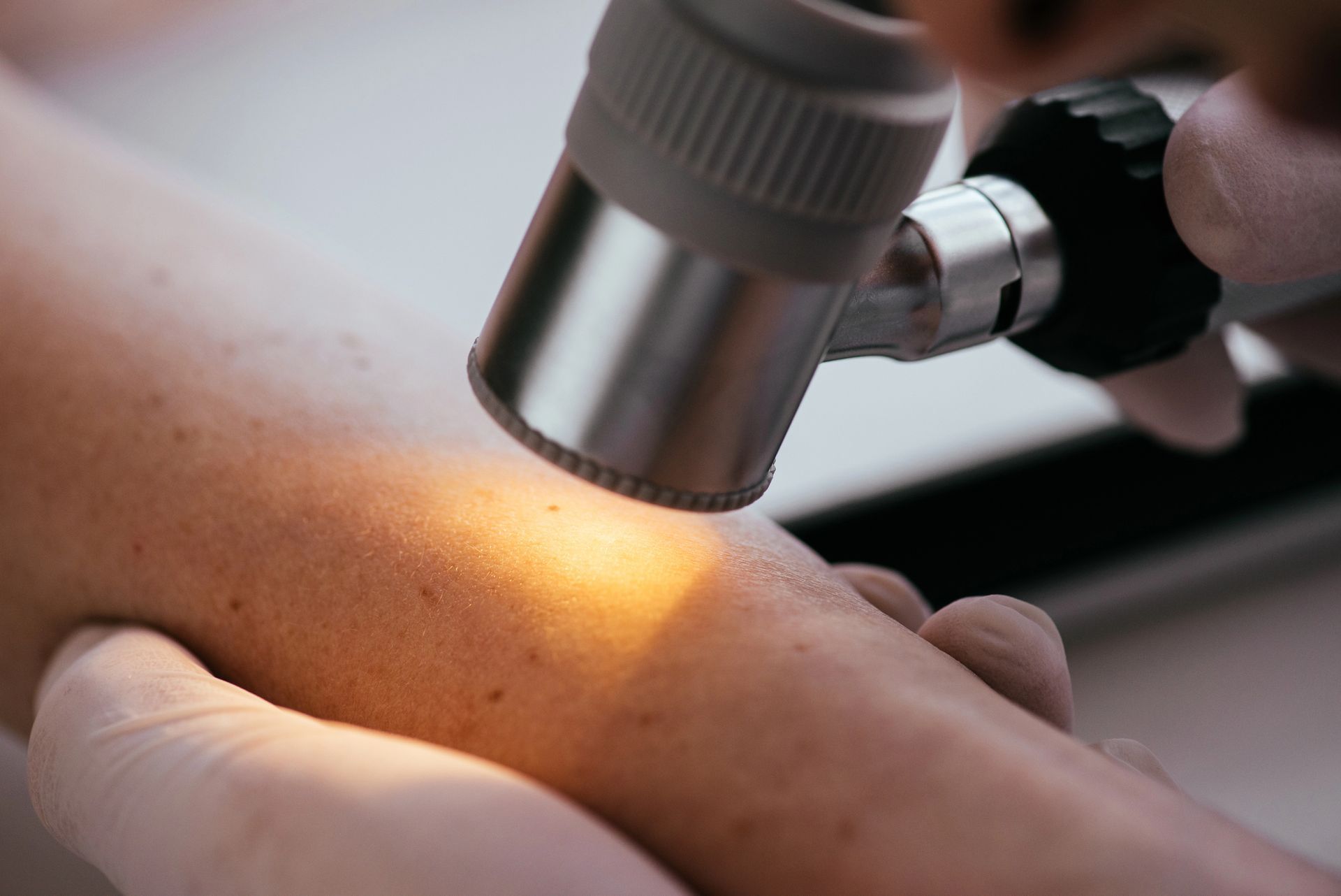Un medico utilizza un dermatoscopio per esaminare il braccio di un paziente e verificare eventuali condizioni della pelle.