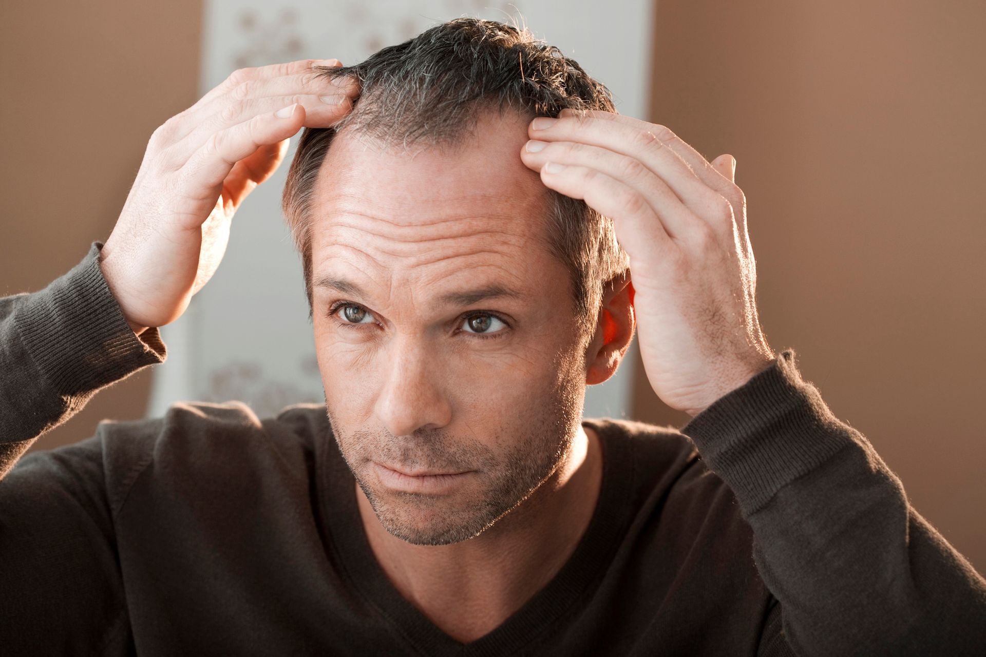 Un uomo si esamina i capelli radi, con le mani sulla testa, e si guarda allo specchio.