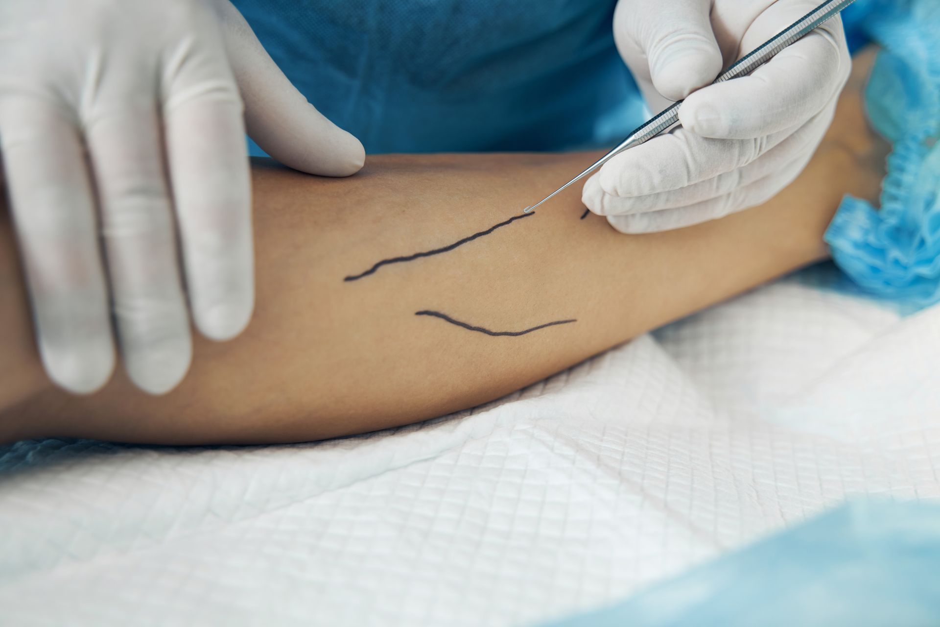 Medical inspection of varicose veins.