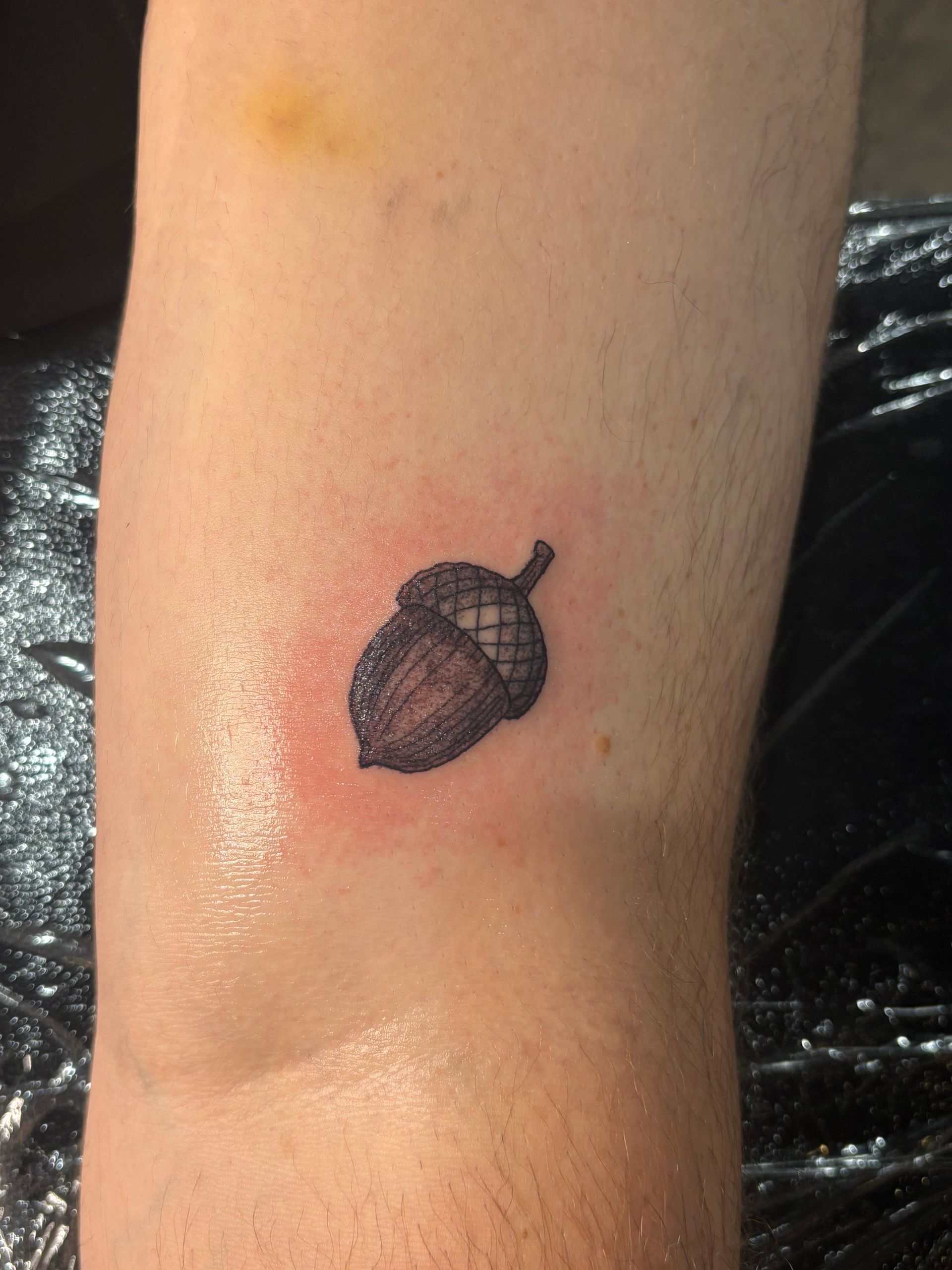 Close-up of a forearm with a small acorn tattoo and slight redness around it