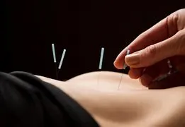 A practitioner inserts thin acupuncture needles into a patient's back against a dark background.