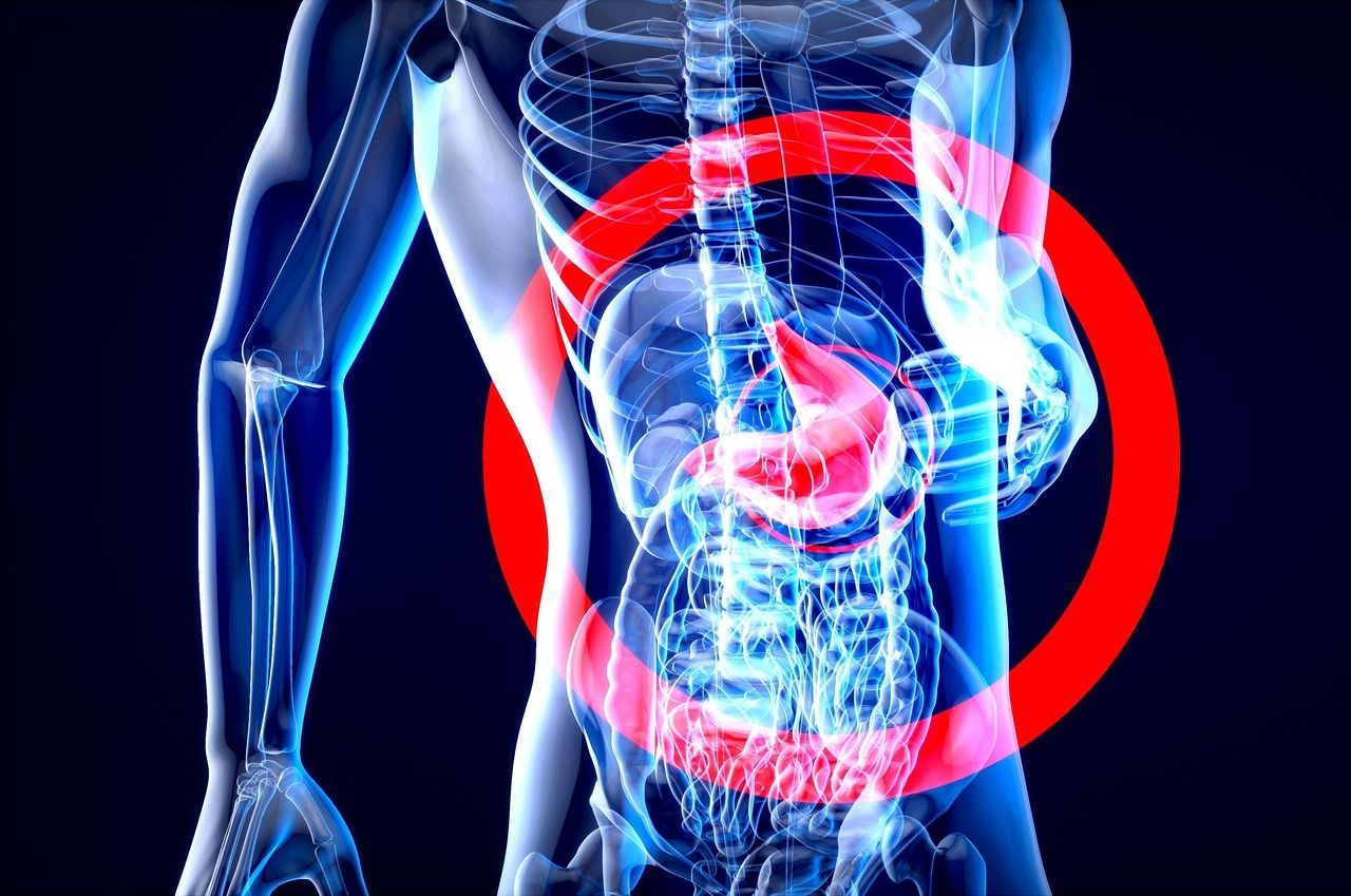 X-ray of torso with red circle highlighting stomach and intestines.
