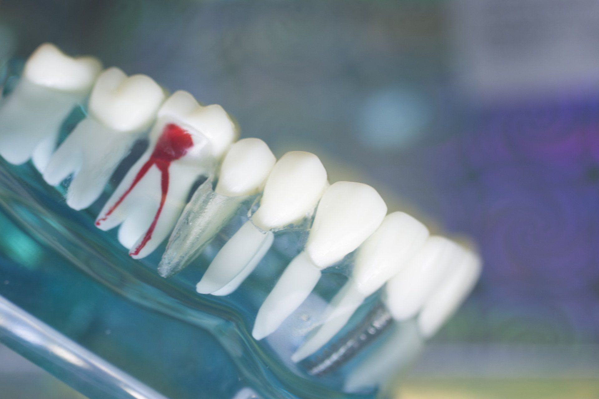 Model of a root canal