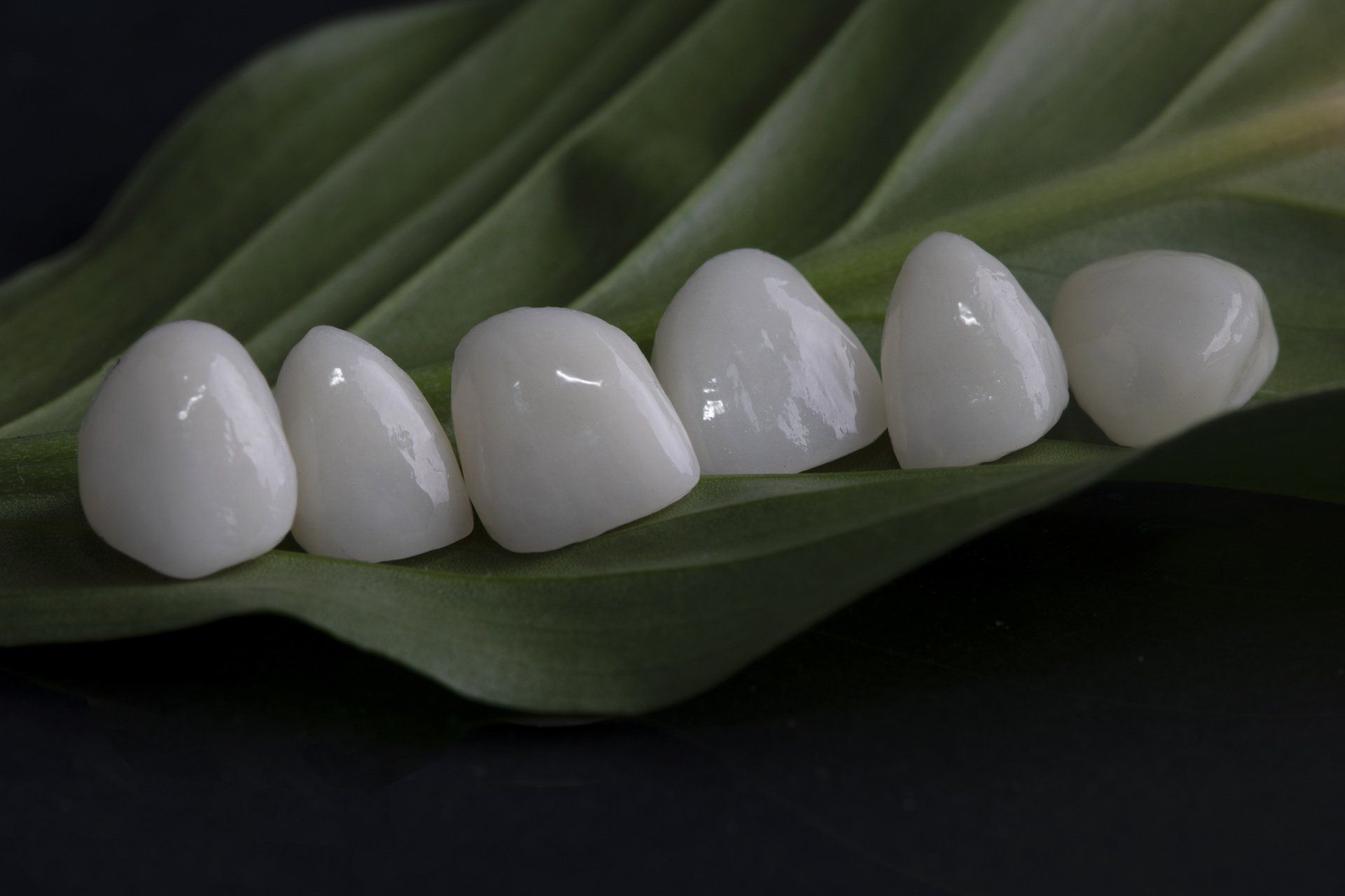 Porcelain Veneers