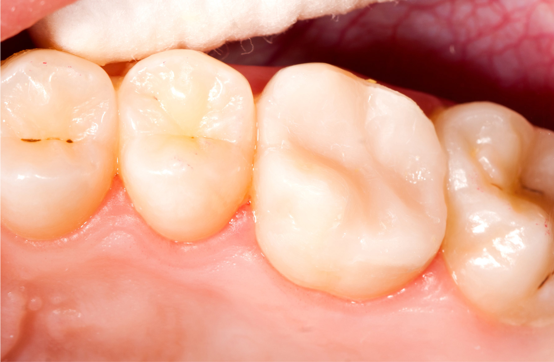Image of teeth 