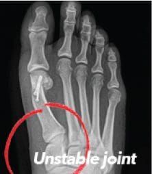 X-Ray