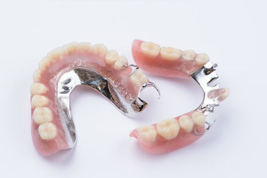 Patient receiving partial dentures for tooth replacement. Patient receiving partial dentures for tooth replacement.