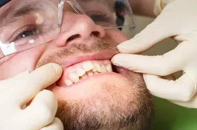 Dental team providing occlusal guard for tooth protection Dental team providing occlusal guard for tooth protection