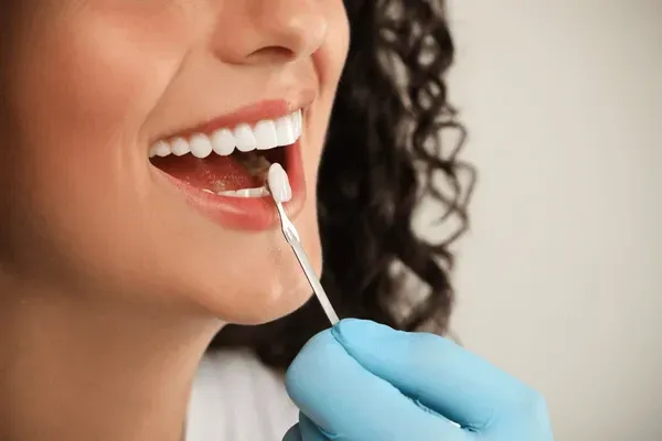 Patient using Poladay whitening gel at home Patient using Poladay whitening gel at home