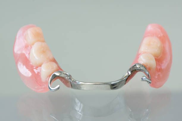 Custom partial dentures at Central City Dentistry, Concord, NH Custom partial dentures at Central City Dentistry, Concord, NH
