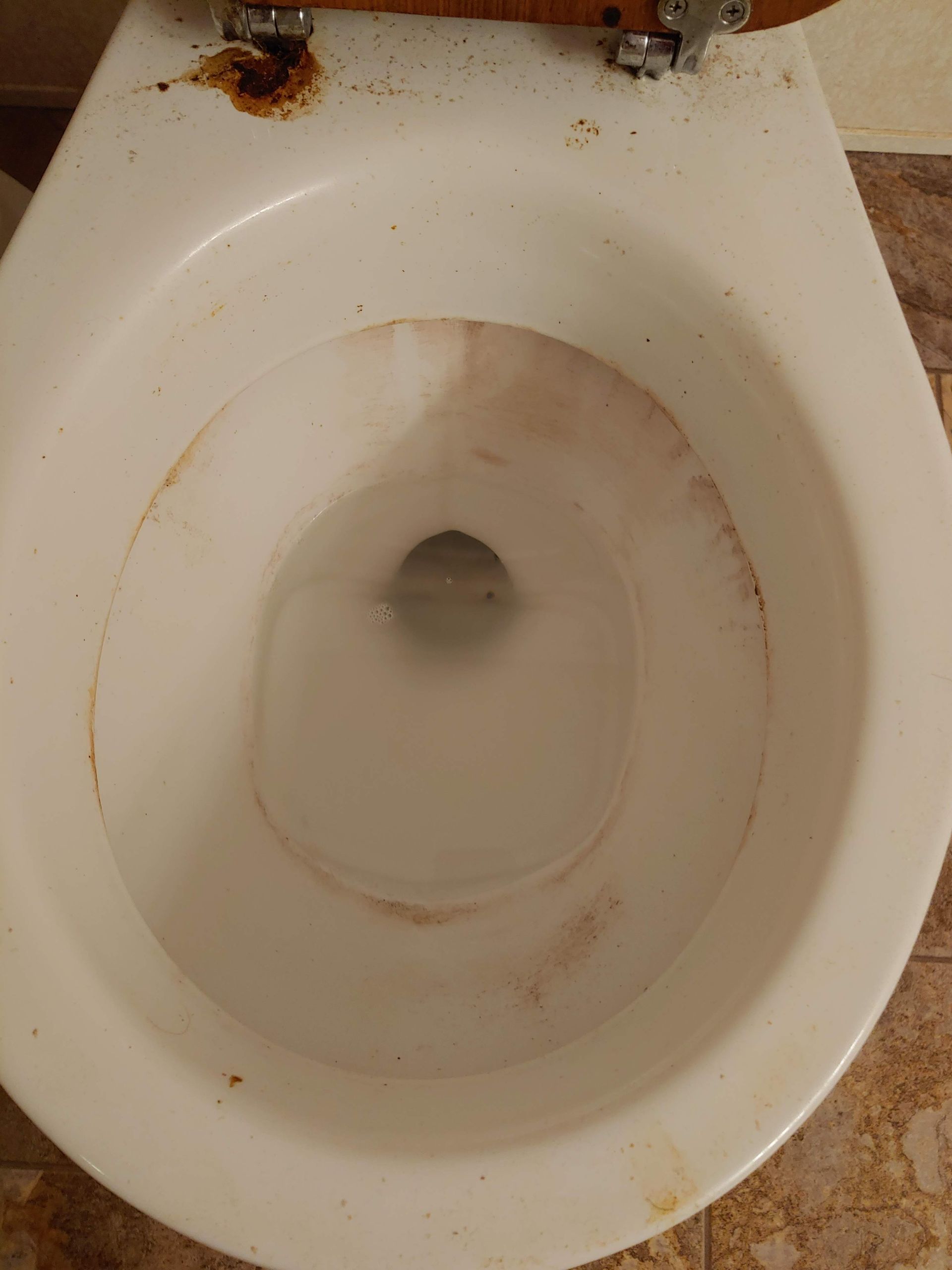 Dirty Toilet